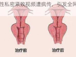 女性私密紧致视频遭疯传，引发全网热议