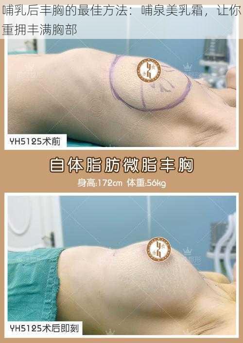 哺乳后丰胸的最佳方法：哺泉美乳霜，让你重拥丰满胸部